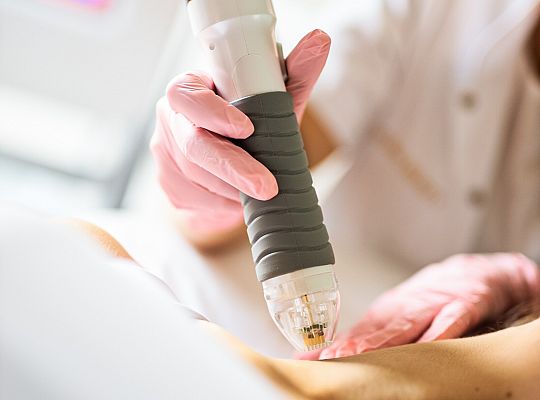 Radiofrekwencja mikroigłowa